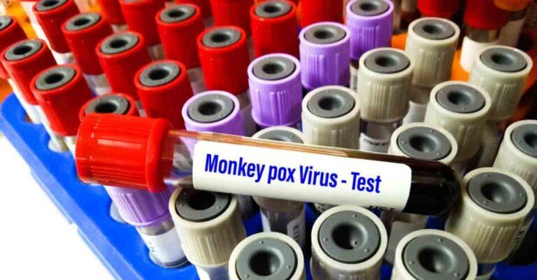 Task force formed to closely monitor monkeypox virus situation in country