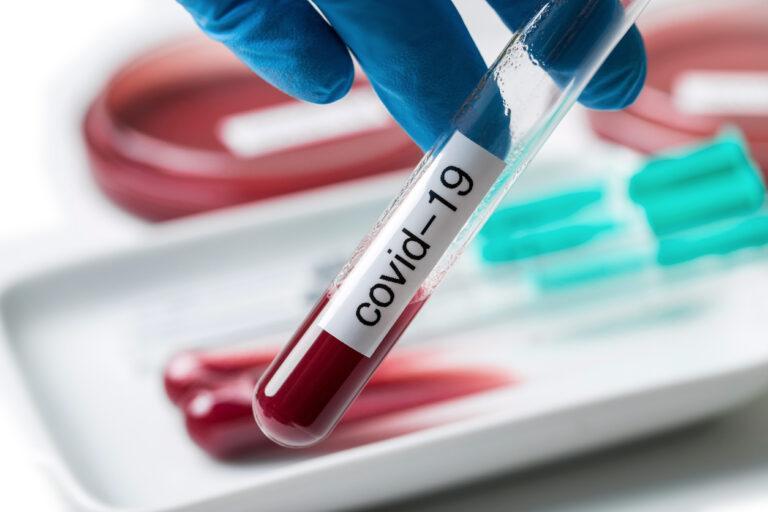 Active Covid cases decline to 40,979