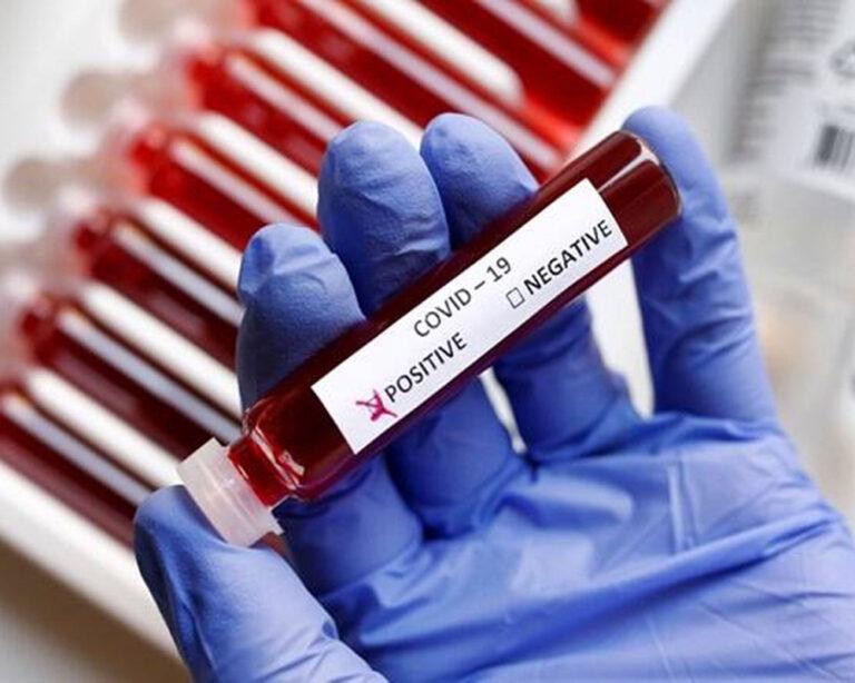 India records 4,272 Covid cases in a day; death toll rises to 5,28,611