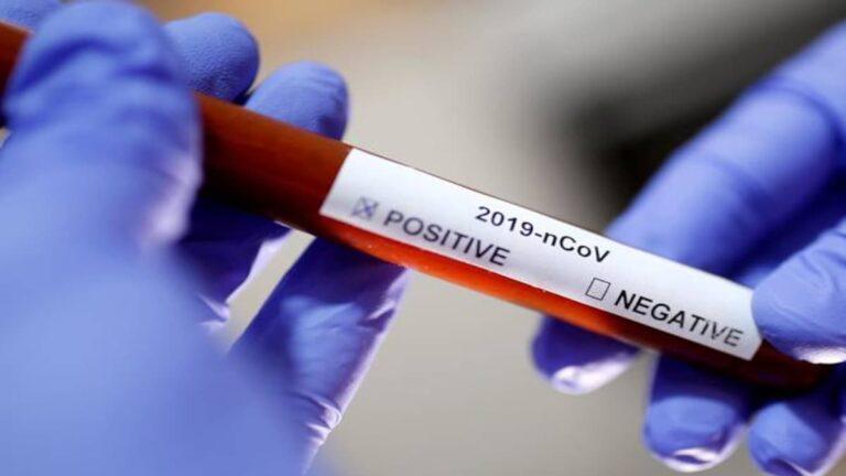India adds 2,797 coronavirus infections, active cases drop below 30K after 122 days